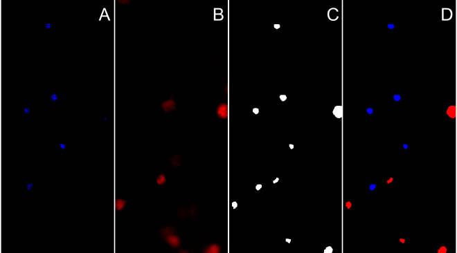 Steps of segmenting cell nucleus